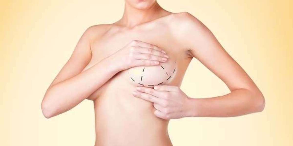 Breast Augmentation in Dubai & Tummy Tuck in Dubai by Dr. Hans Plastic Surgeon